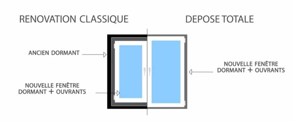 schema dépose totale millet
